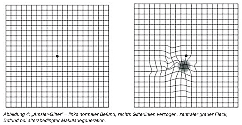 wrestler steroide – Lektionen aus Google